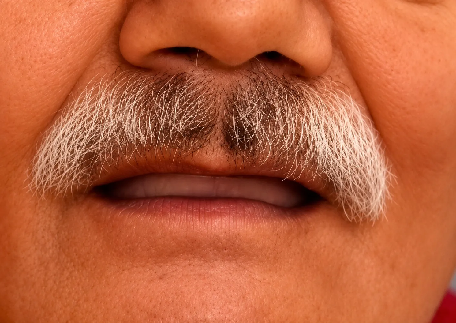 Before Treatment